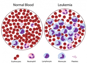 Leukemia blood.jpg